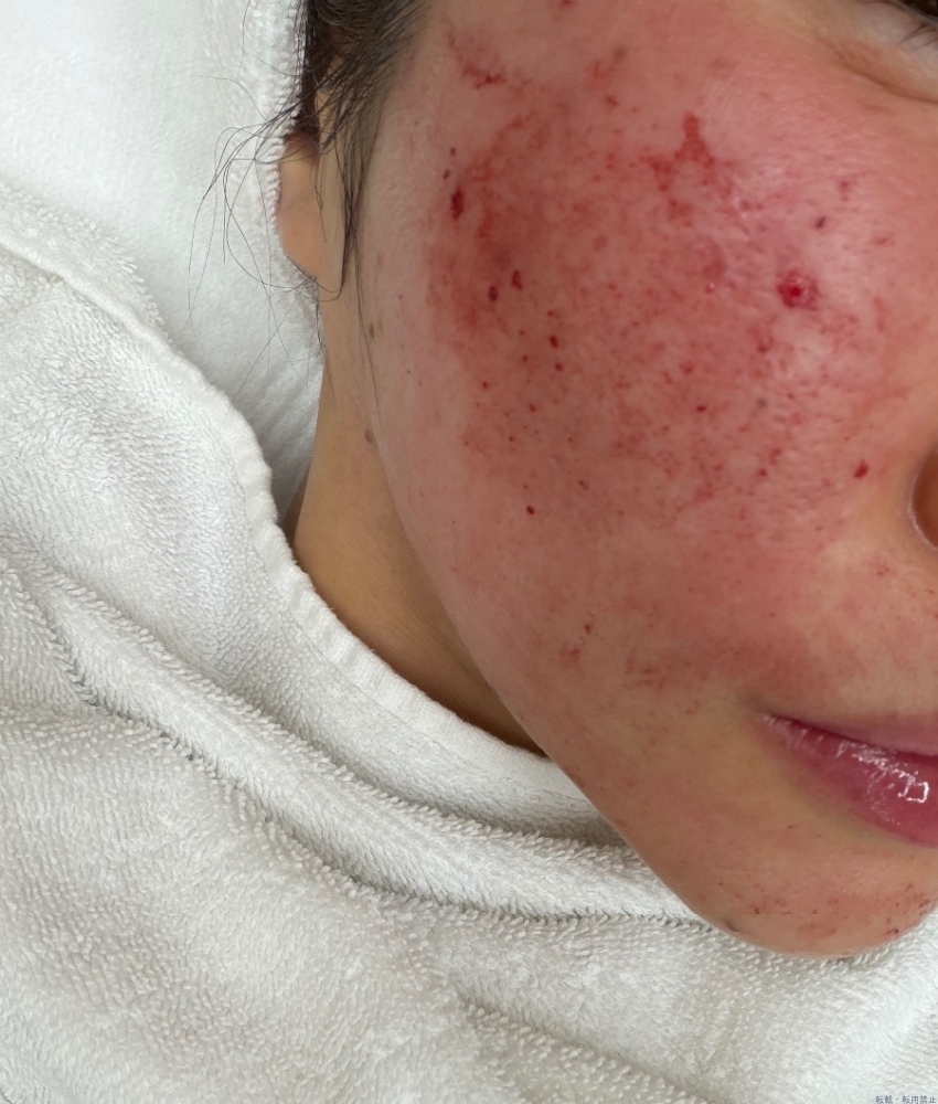 新着女の子ブログ画像