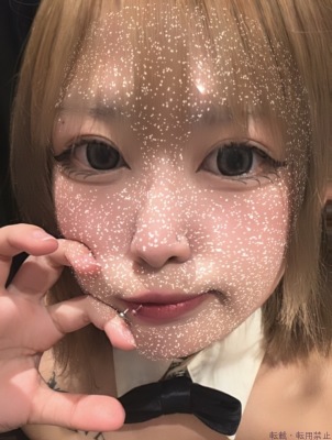 らん